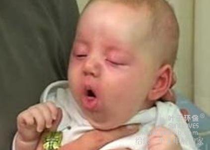 宝宝出现这5种症状，很大概率是甲醛中毒